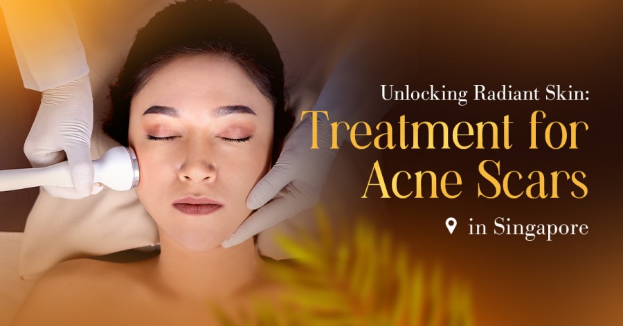 Unlocking Radiant Skin: Treatment for Acne Scars in Singapore
